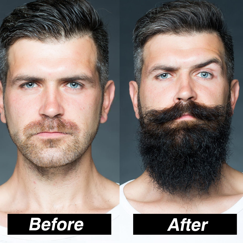 Hair Growth Enhancer